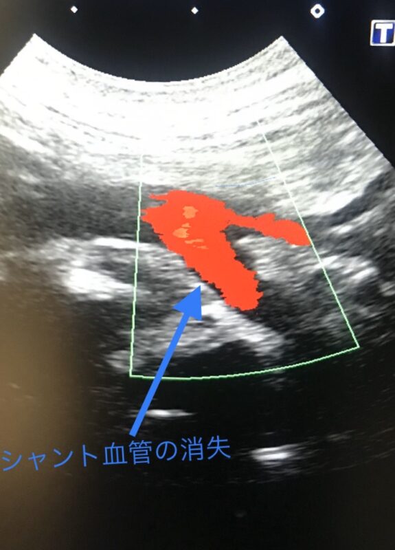 門脈体循環シャント（PSS） 藤沢市 鎌倉市大船の藤沢ゆい動物病院